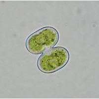 Cosmarium contractum