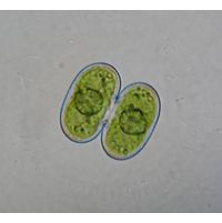 Cosmarium contractum