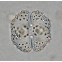 Cosmarium corbula