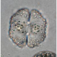 Cosmarium corbula