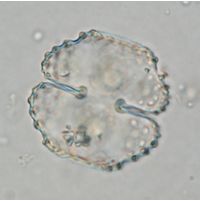 Cosmarium corbula