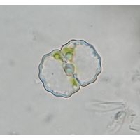 Cosmarium crenulatum