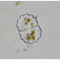 Cosmarium crenulatum