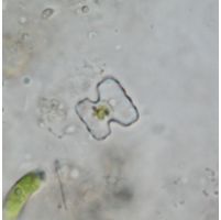 Cosmarium cymatonotophorum