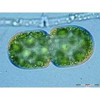 Cosmarium debaryi