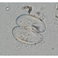 Cosmarium depressum