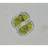 Cosmarium dickii