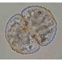 Cosmarium didymoprotupsum