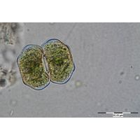 Cosmarium eichlerianum