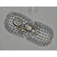 Cosmarium elegantissimum