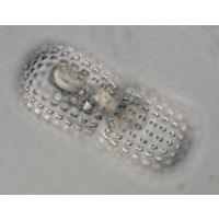 Cosmarium elegantissimum