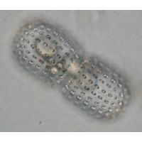 Cosmarium elegantissimum