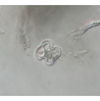 Cosmarium