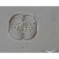 Cosmarium fastidiosum