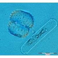 Cosmarium fastidiosum