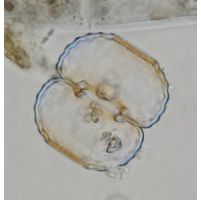 Cosmarium fastidiosum