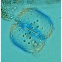 Cosmarium fastidiosum