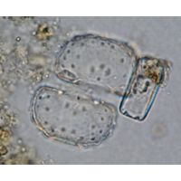 Cosmarium fastidiosum