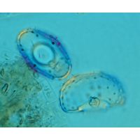 Cosmarium fastidiosum