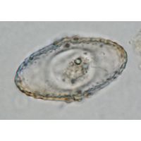 Cosmarium fastidiosum