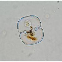 Cosmarium garrolense