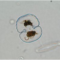 Cosmarium garrolense