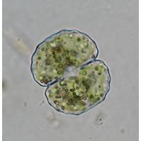 Cosmarium gibberulum