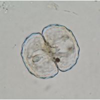 Cosmarium gibberulum