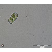 Cosmarium gonoides