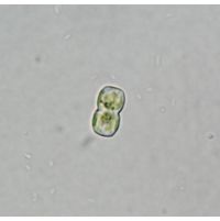 Cosmarium gonoides