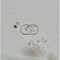Cosmarium gonoides