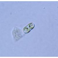 Cosmarium gonoides
