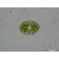 Cosmarium granatum