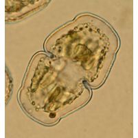 Cosmarium holmiense