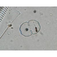 Cosmarium impressulum