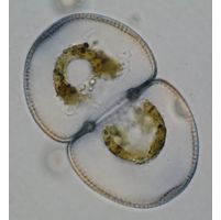 Cosmarium incrassatum