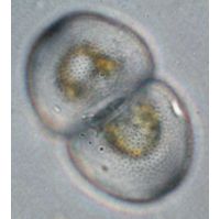 Cosmarium incrassatum