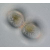 Cosmarium incrassatum