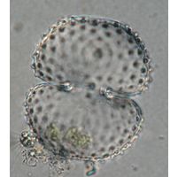 Cosmarium kirchneri