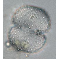 Cosmarium kirchneri