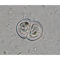 Cosmarium laeve