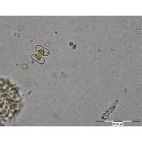 Cosmarium