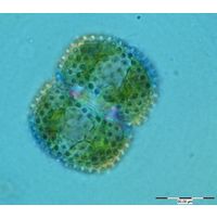 Cosmarium margaritatum