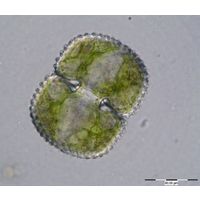 Cosmarium margaritatum