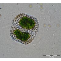 Cosmarium margaritiferum