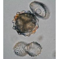 Cosmarium margaritiferum
