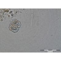 Cosmarium medioretusum