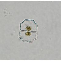 Cosmarium meneghinii