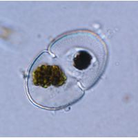 Cosmarium microsphinctum