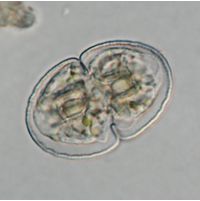 Cosmarium microsphinctum